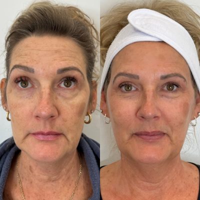 9B27B275-BBB3-4095-A15D-20448DC5000E